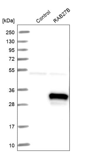 RAB27B Antibody - BSA Free Western Blot: RAB27B Antibody - BSA Free [NBP1-89538]