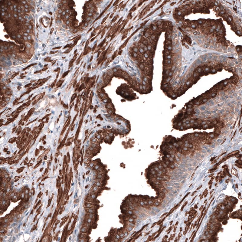 RAB27B Antibody - BSA Free Immunohistochemistry-Paraffin: RAB27B Antibody - BSA Free [NBP1-89538]