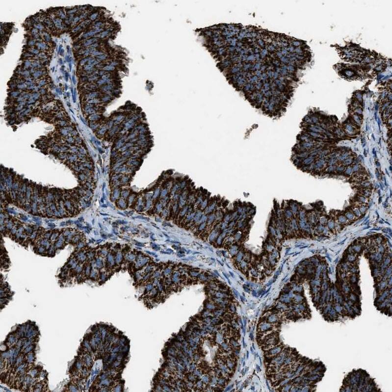 MDH2 Antibody - BSA Free Immunohistochemistry-Paraffin: MDH2 Antibody - BSA Free [NBP1-89539]
