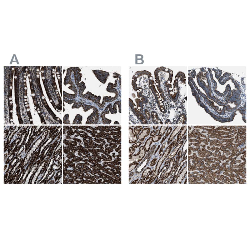 MDH2 Antibody - BSA Free Immunohistochemistry-Paraffin: MDH2 Antibody - BSA Free [NBP1-89539]