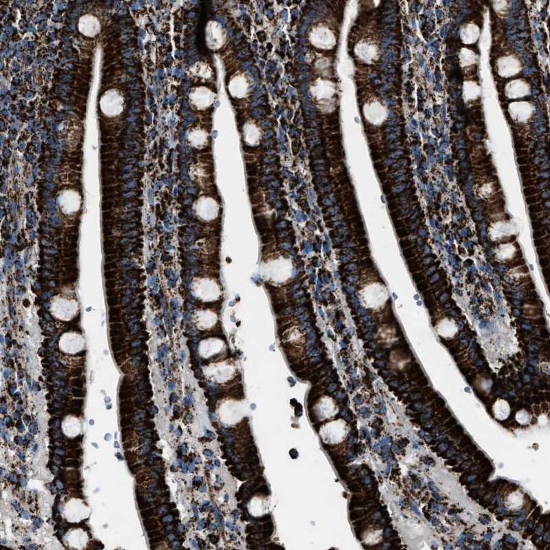 MDH2 Antibody - BSA Free Immunohistochemistry-Paraffin: MDH2 Antibody - BSA Free [NBP1-89539]