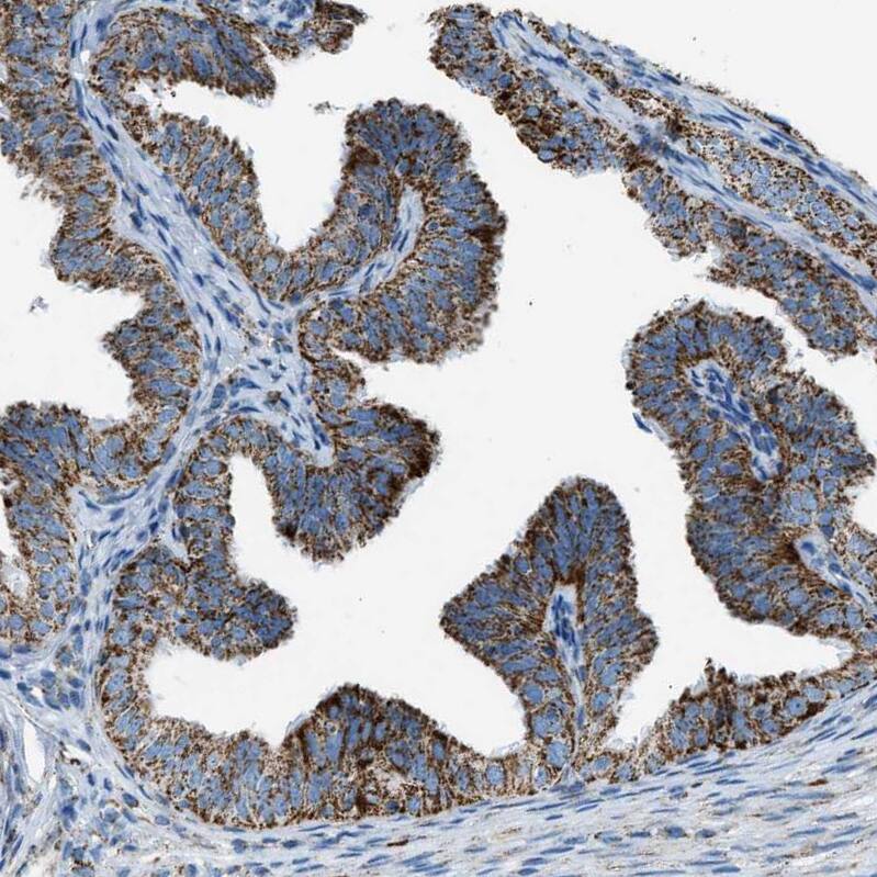 MDH2 Antibody - BSA Free Immunohistochemistry-Paraffin: MDH2 Antibody - BSA Free [NBP1-89540]