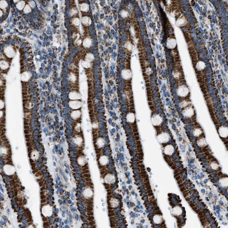 MDH2 Antibody - BSA Free Immunohistochemistry-Paraffin: MDH2 Antibody - BSA Free [NBP1-89540]
