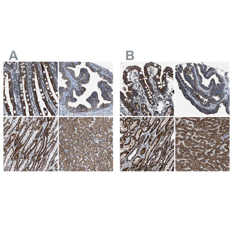 MDH2 Antibody - BSA Free Immunohistochemistry-Paraffin: MDH2 Antibody - BSA Free [NBP1-89540]