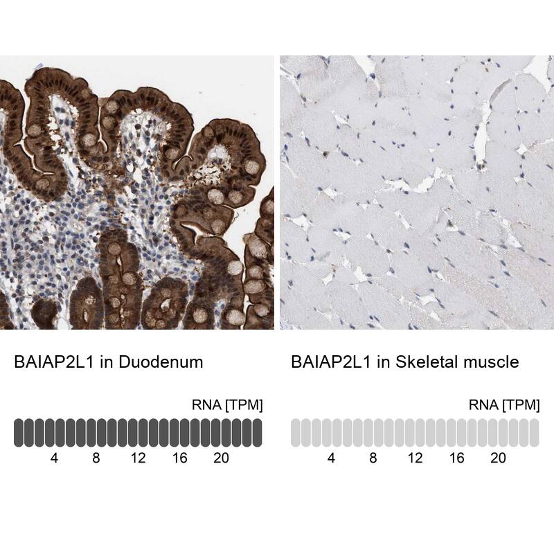 BAIAP2L1 Antibody - BSA Free Immunohistochemistry-Paraffin: BAIAP2L1 Antibody - BSA Free [NBP1-89542]