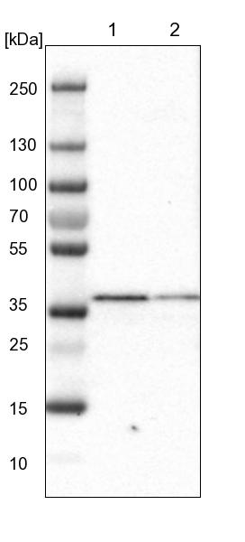 SCAMP2 Antibody - BSA Free Western Blot: SCAMP2 Antibody - BSA Free [NBP1-89543]