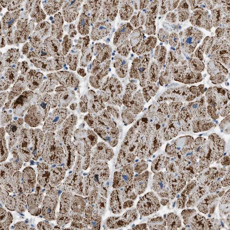 ETFB Antibody - BSA Free Immunohistochemistry-Paraffin: ETFB Antibody [NBP1-89545]