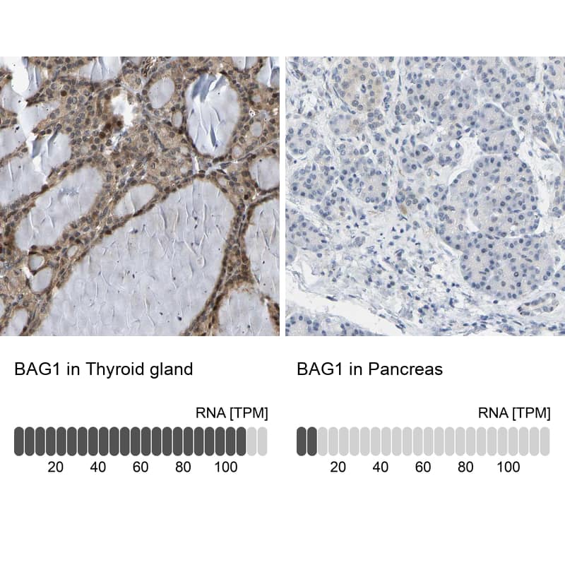 Bag-1 Antibody - BSA Free Immunohistochemistry-Paraffin: Bag-1 Antibody - BSA Free [NBP1-89547]