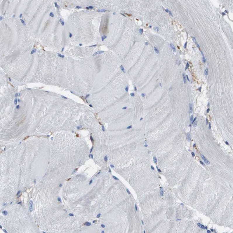 LPP Antibody - BSA Free Immunohistochemistry-Paraffin: LPP Antibody - BSA Free [NBP1-89549]