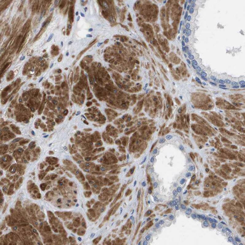 LPP Antibody - BSA Free Immunohistochemistry-Paraffin: LPP Antibody - BSA Free [NBP1-89549]