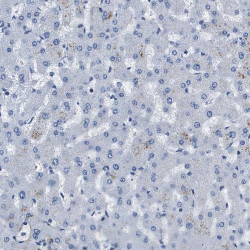 LPP Antibody - BSA Free Immunohistochemistry-Paraffin: LPP Antibody - BSA Free [NBP1-89549]