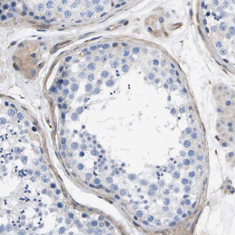 LPP Antibody - BSA Free Immunohistochemistry-Paraffin: LPP Antibody - BSA Free [NBP1-89549]