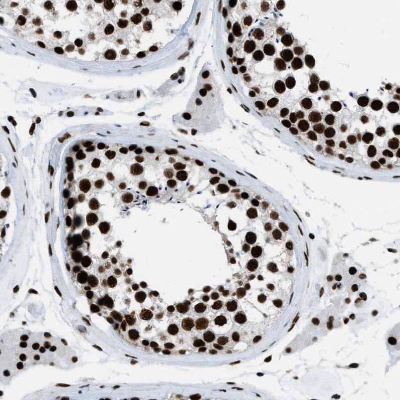 ZNF207 Antibody - BSA Free Immunohistochemistry-Paraffin: ZNF207 Antibody - BSA Free [NBP1-89550]