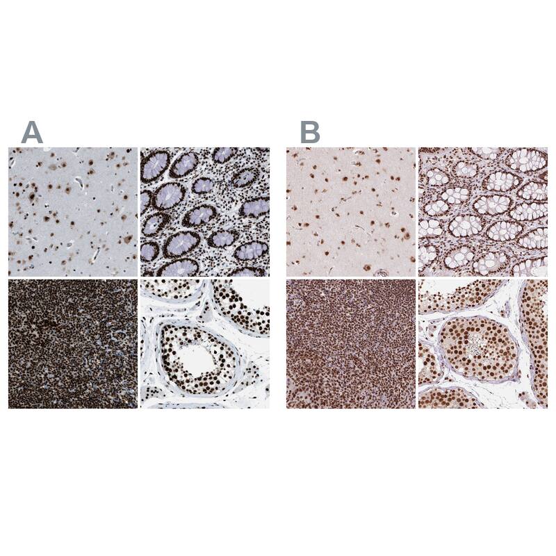 ZNF207 Antibody - BSA Free Immunohistochemistry-Paraffin: ZNF207 Antibody - BSA Free [NBP1-89550]
