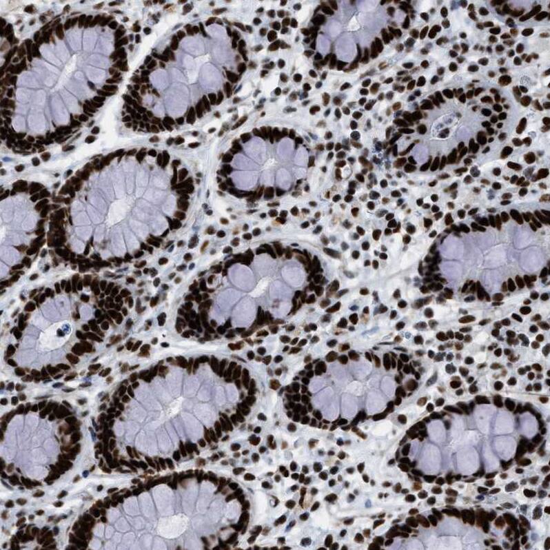 ZNF207 Antibody - BSA Free Immunohistochemistry-Paraffin: ZNF207 Antibody - BSA Free [NBP1-89550]