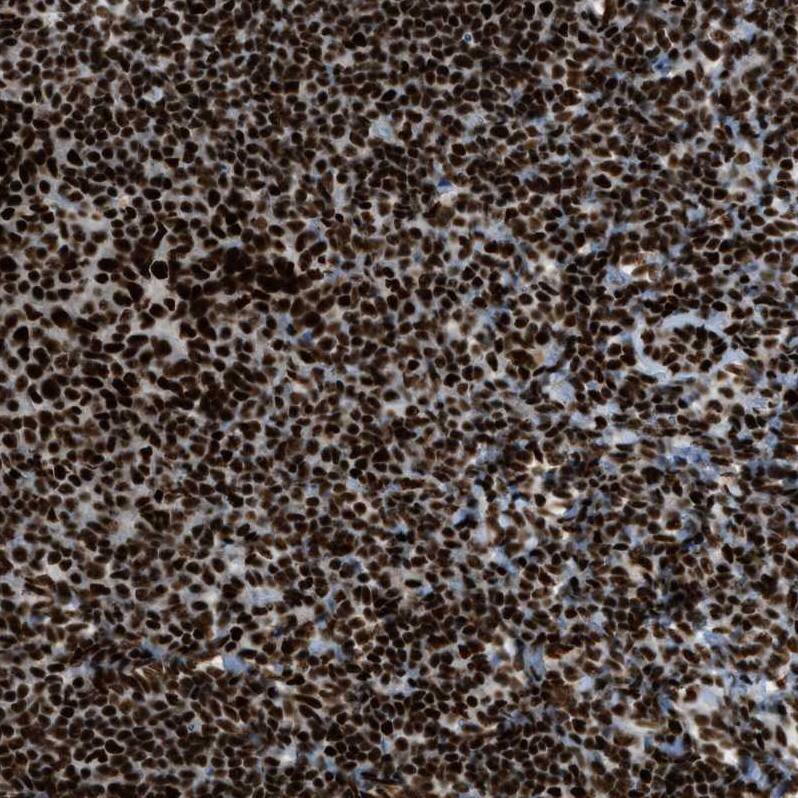 ZNF207 Antibody - BSA Free Immunohistochemistry-Paraffin: ZNF207 Antibody - BSA Free [NBP1-89550]