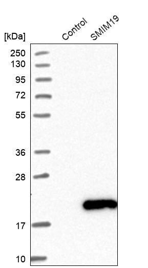 SMIM19 Antibody - BSA Free Western Blot: SMIM19 Antibody - BSA Free [NBP1-89554]