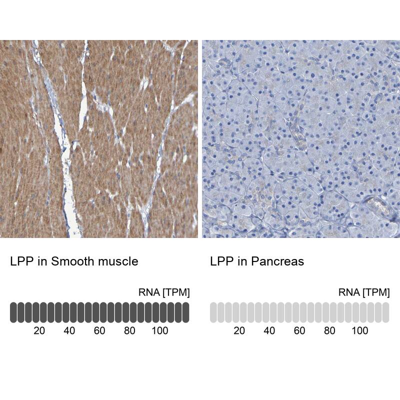 LPP Antibody - BSA Free Immunohistochemistry-Paraffin: LPP Antibody - BSA Free [NBP1-89555]