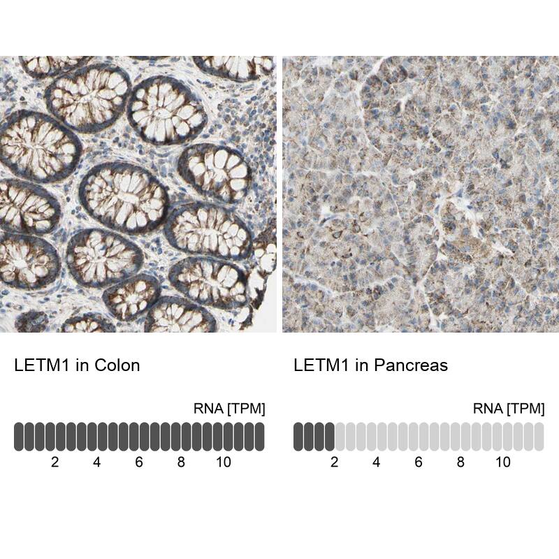 LETM1 Antibody - BSA Free Immunohistochemistry-Paraffin: LETM1 Antibody - BSA Free [NBP1-89556]