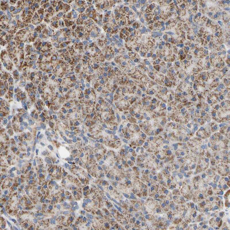 CLPP Antibody - BSA Free Immunohistochemistry-Paraffin: CLPP Antibody [NBP1-89557]