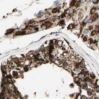 ME2 Antibody - BSA Free Immunohistochemistry-Paraffin: ME2 Antibody - BSA Free [NBP1-89559]
