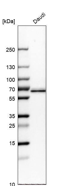 ME2 Antibody - BSA Free Western Blot: ME2 Antibody - BSA Free [NBP1-89559]