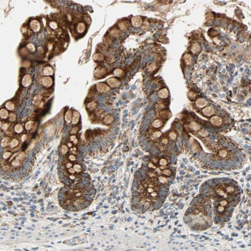 MRPL9 Antibody - BSA Free Immunohistochemistry-Paraffin: MRPL9 Antibody - BSA Free [NBP1-89561]