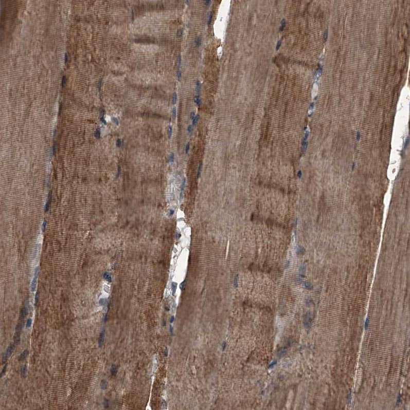 Sin1/MAPKAP1 Antibody - BSA Free Immunohistochemistry-Paraffin: Sin1/MAPKAP1 Antibody - BSA Free [NBP1-89568]