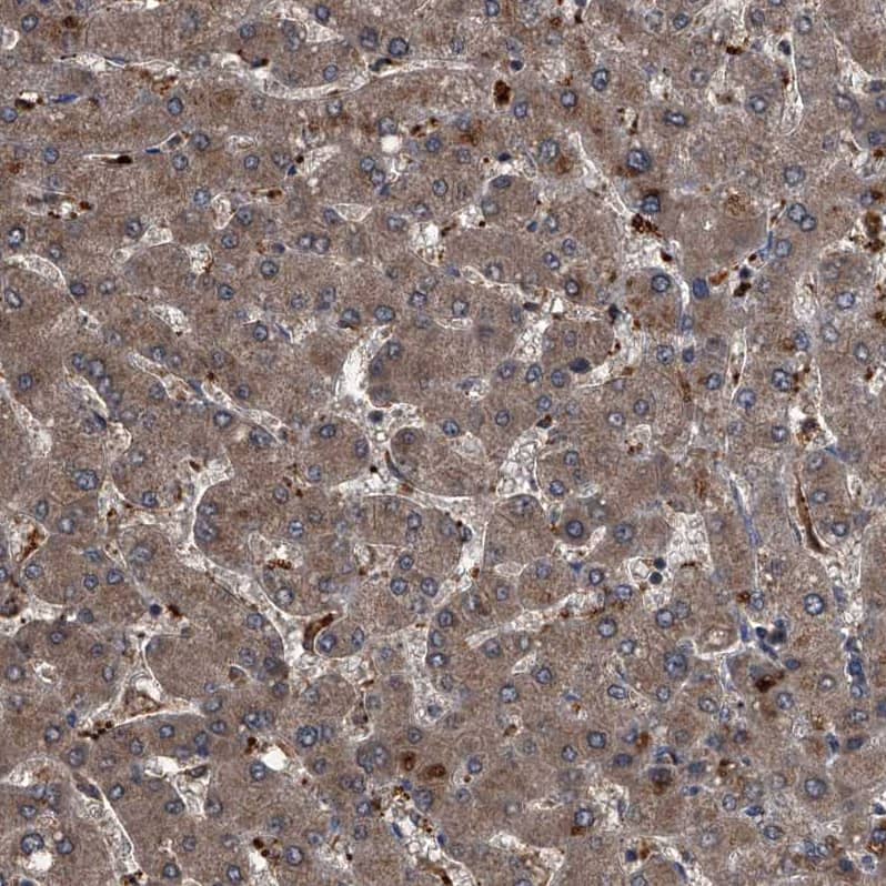 Sin1/MAPKAP1 Antibody - BSA Free Immunohistochemistry-Paraffin: Sin1/MAPKAP1 Antibody - BSA Free [NBP1-89568]