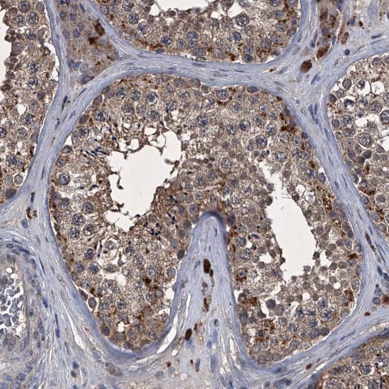 Sin1/MAPKAP1 Antibody - BSA Free Immunohistochemistry-Paraffin: Sin1/MAPKAP1 Antibody - BSA Free [NBP1-89568]