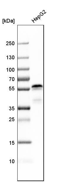 Ajuba Antibody - BSA Free Western Blot: Ajuba Antibody - BSA Free [NBP1-89570]