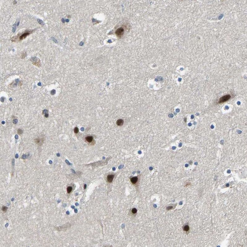 RNF12 Antibody - BSA Free Immunohistochemistry-Paraffin: RNF12 Antibody - BSA Free [NBP1-89571]