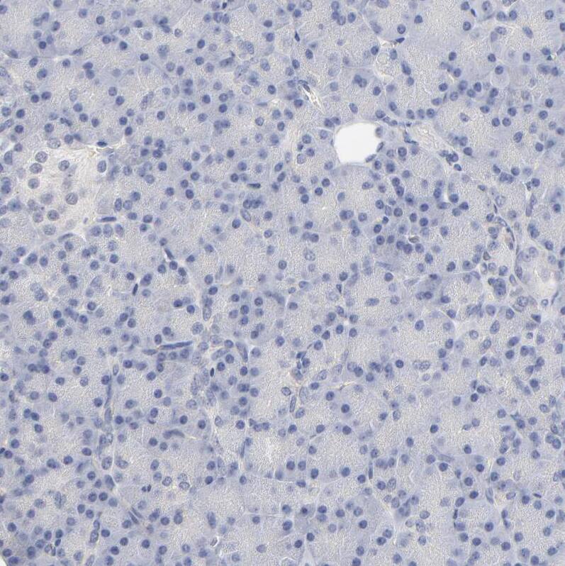 MCT1/SLC16A1 Antibody - BSA Free Immunohistochemistry-Paraffin: MCT1/SLC16A1 Antibody - BSA Free [NBP1-89574]