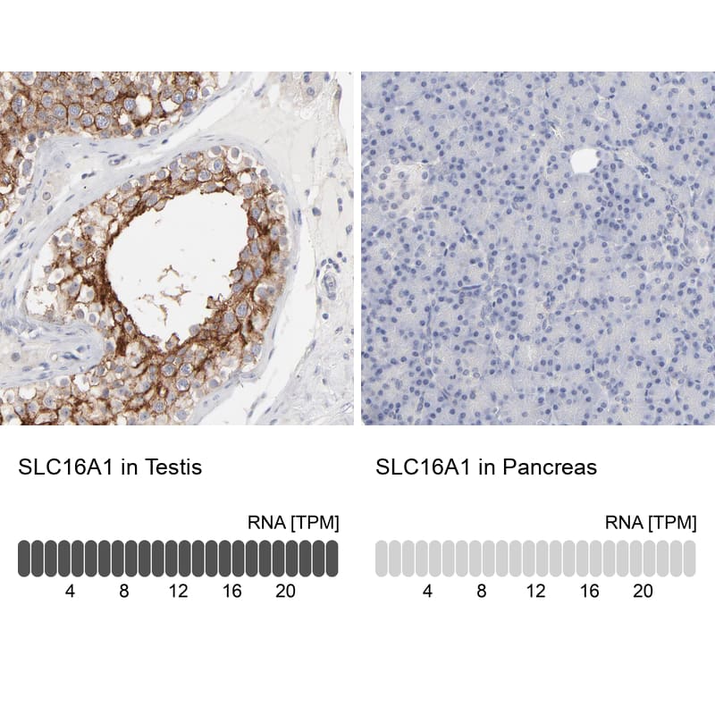 MCT1/SLC16A1 Antibody - BSA Free Immunohistochemistry-Paraffin: MCT1/SLC16A1 Antibody - BSA Free [NBP1-89574]