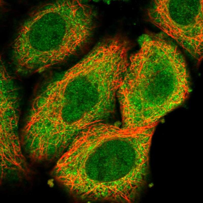 LYK5 Antibody - BSA Free Immunocytochemistry/ Immunofluorescence: LYK5 Antibody [NBP1-89577]