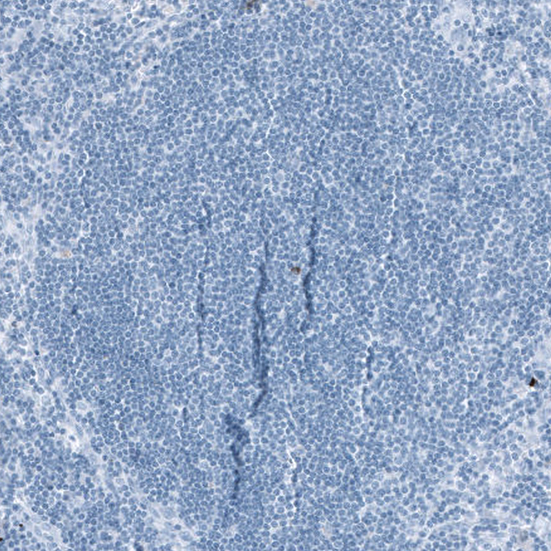 Relaxin R1/LGR7 Antibody - BSA Free Immunohistochemistry-Paraffin: Relaxin R1/LGR7 Antibody - BSA Free [NBP1-89585]