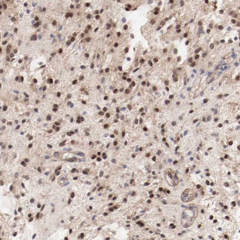 MAGED4B Antibody - BSA Free Immunohistochemistry-Paraffin: MAGED4B Antibody - BSA Free [NBP1-89594]