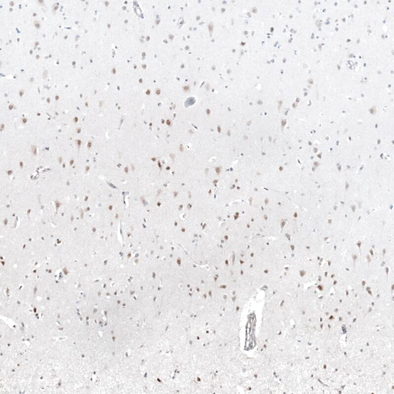 MAGED4B Antibody - BSA Free Immunohistochemistry-Paraffin: MAGED4B Antibody - BSA Free [NBP1-89594]