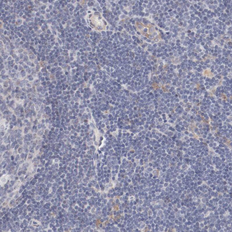 MAGED4B Antibody - BSA Free Immunohistochemistry-Paraffin: MAGED4B Antibody - BSA Free [NBP1-89594]