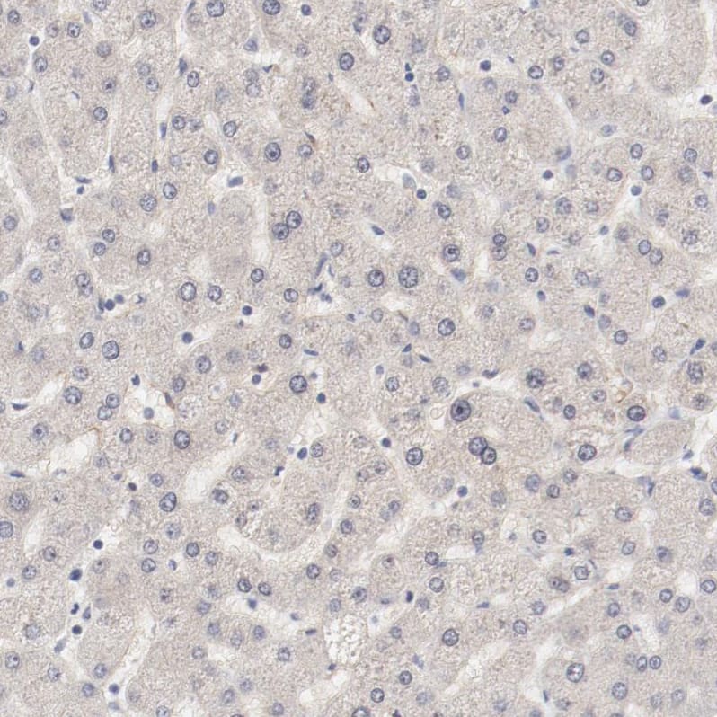 MAGED4B Antibody - BSA Free Immunohistochemistry-Paraffin: MAGED4B Antibody - BSA Free [NBP1-89594]