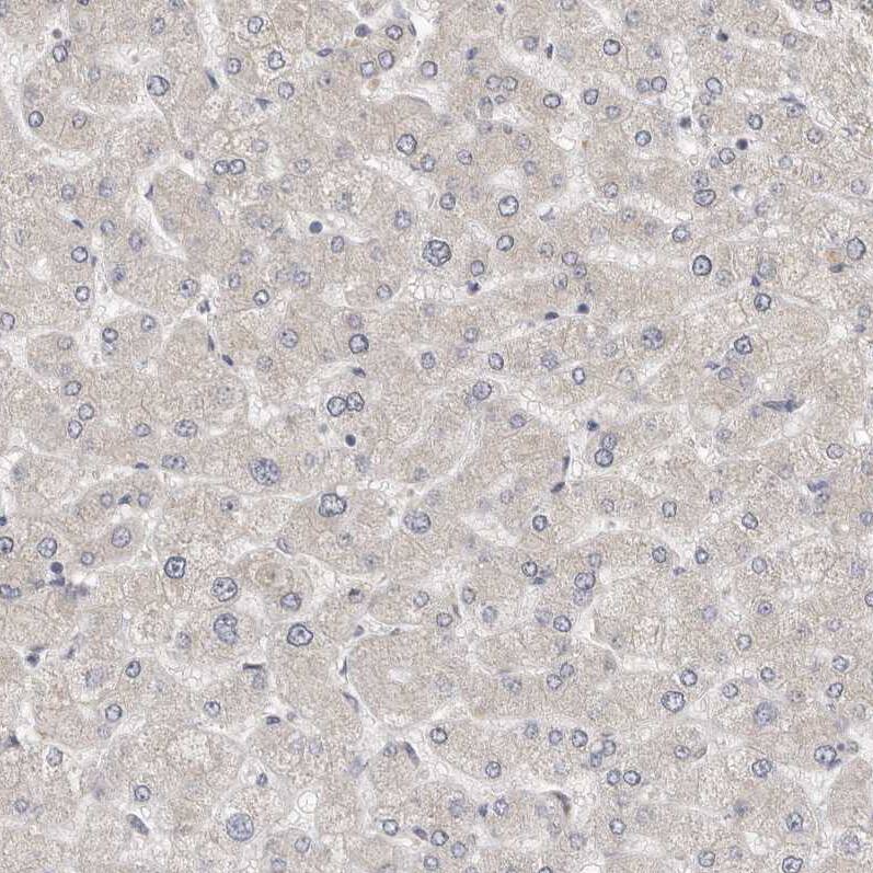 UNK Antibody - BSA Free Immunohistochemistry-Paraffin: UNK Antibody - BSA Free [NBP1-89596]