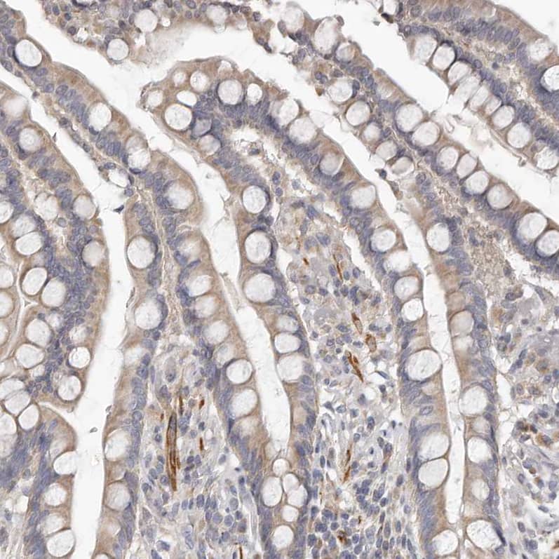 UNK Antibody - BSA Free Immunohistochemistry-Paraffin: UNK Antibody - BSA Free [NBP1-89596]
