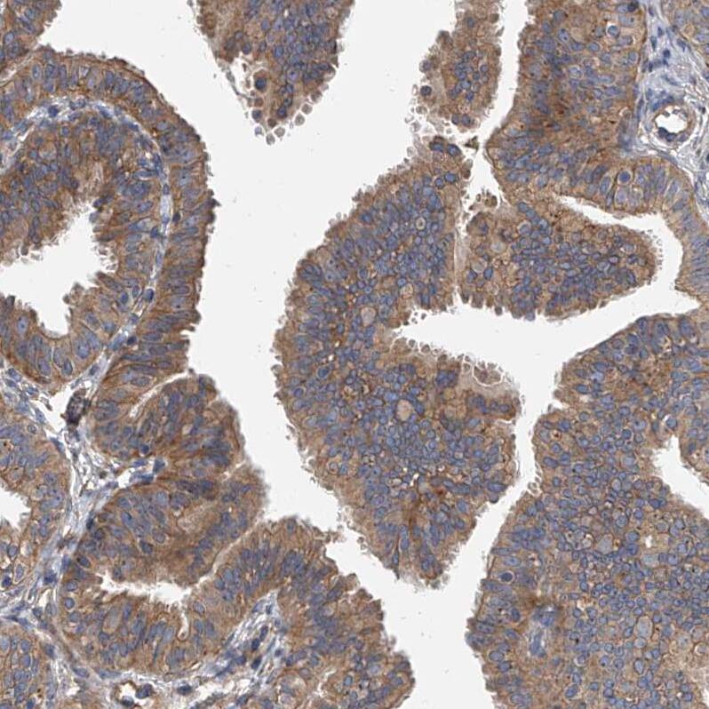 Sec8 Antibody - BSA Free Immunohistochemistry-Paraffin: Sec8 Antibody - BSA Free [NBP1-89597]