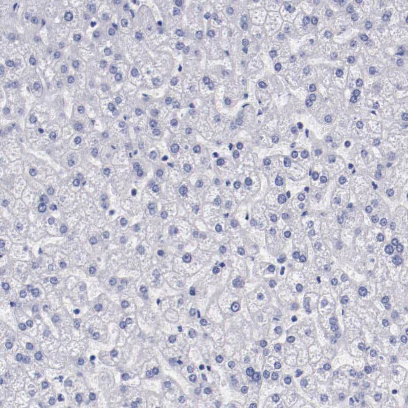 Periaxin Antibody - BSA Free Immunohistochemistry-Paraffin: Periaxin Antibody - BSA Free [NBP1-89598]