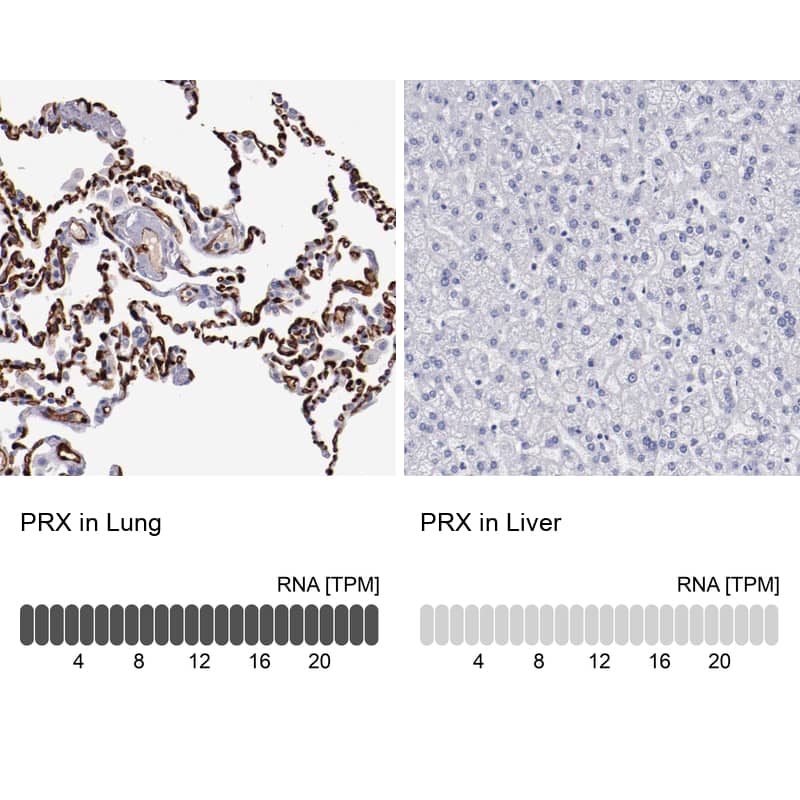 Periaxin Antibody - BSA Free Immunohistochemistry-Paraffin: Periaxin Antibody - BSA Free [NBP1-89598]