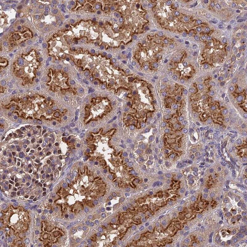PIKFyve/PIP5K3 Antibody - BSA Free Immunohistochemistry-Paraffin: PIKFyve/PIP5K3 Antibody - BSA Free [NBP1-89613]