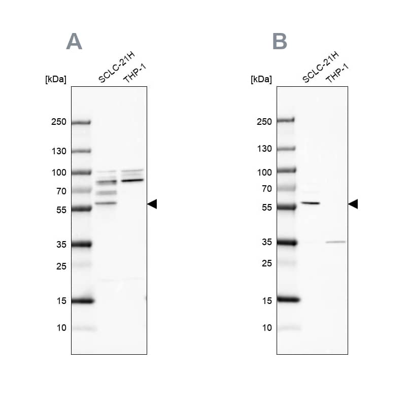 RIPX Antibody - BSA Free Western Blot: RIPX Antibody - BSA Free [NBP1-89614]