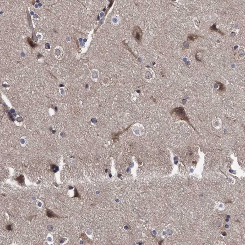 COBL Antibody - BSA Free Immunohistochemistry-Paraffin: COBL Antibody - BSA Free [NBP1-89615]