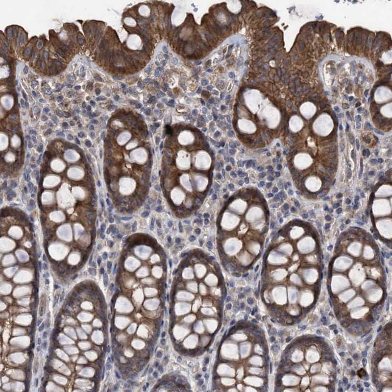 COBL Antibody - BSA Free Immunohistochemistry-Paraffin: COBL Antibody - BSA Free [NBP1-89615]
