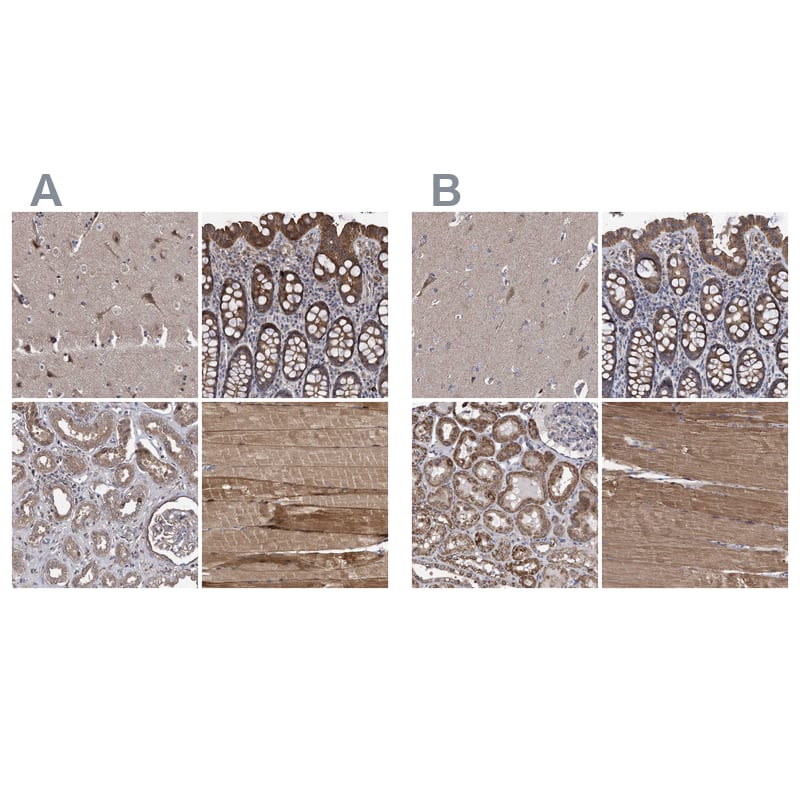 COBL Antibody - BSA Free Immunohistochemistry-Paraffin: COBL Antibody - BSA Free [NBP1-89615]